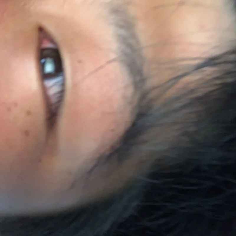 mdpon