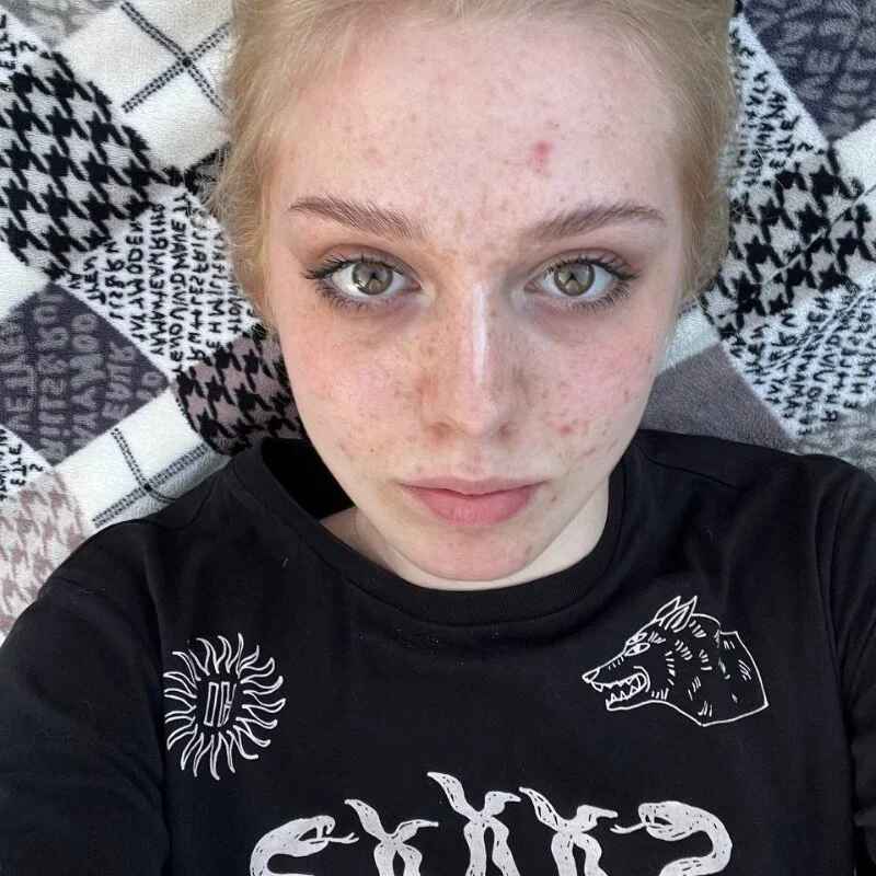 VernieWhit