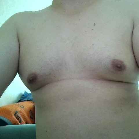 hunk000