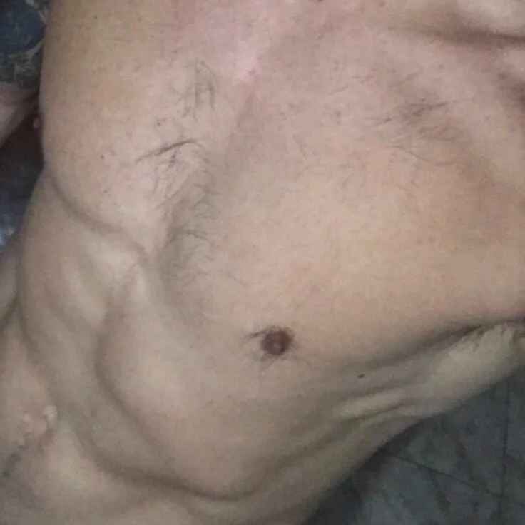 EzeVV
