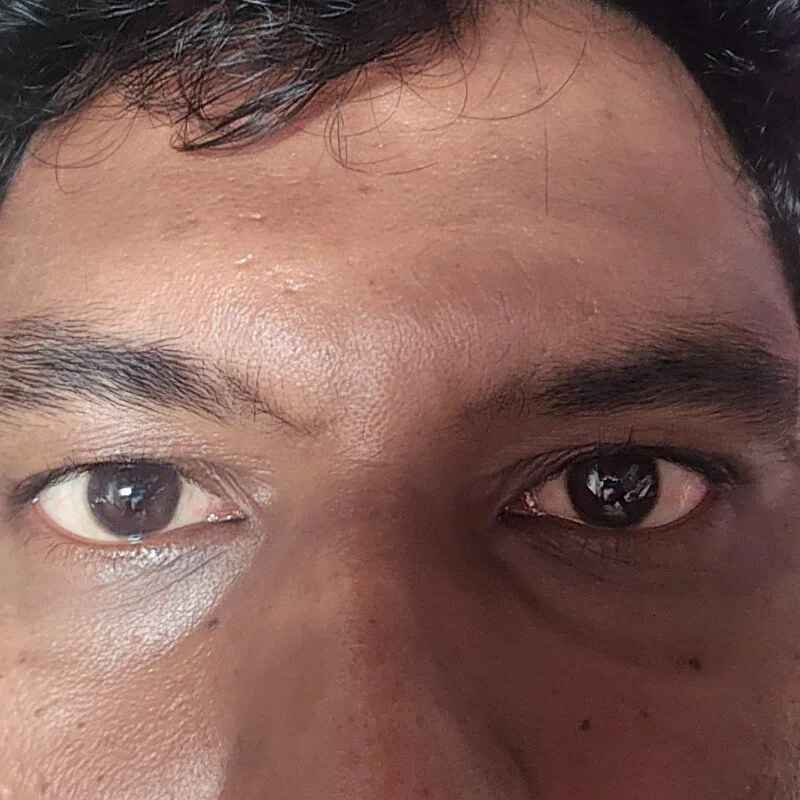 sahi561