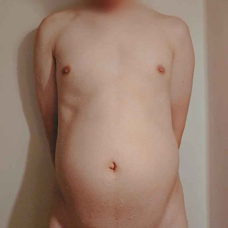ReoBellyInflation