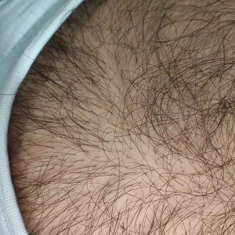 Hairykingh