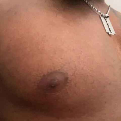 rageros